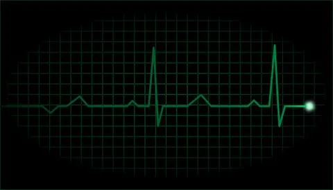 Simple green electrocardiograph display Stock Illustration