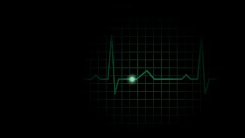 Simple green electrocardiograph pulsation display Stock Footage 71581749