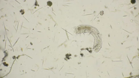 The simplest microorganism worm under a microscope Stock Footage 90238625