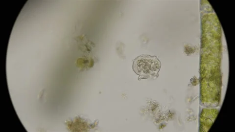 The simplest microorganisms Vorticella under a microscope Stock Footage 92709273