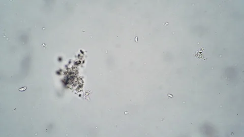 Simplest primitive organisms feed on algae on a white background in a microscope Stock Footage 122109039