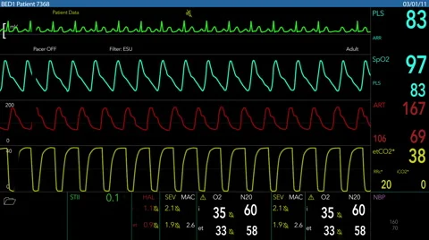 Simulated Heart Monitor Screen 2018 Stock Footage