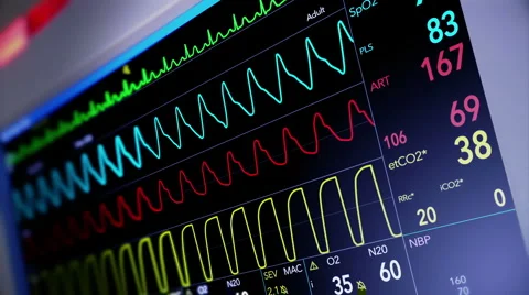 Simulated Heart Monitor Screen Stock Footage