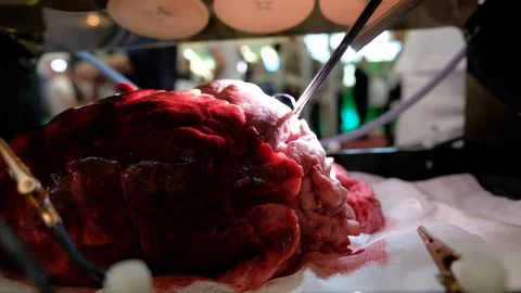 Simulation of heart surgery Stock Footage 89567456