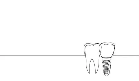 Single continuous line art anatomical human tooth silhouette implant. Healthy Stock-Illustration
