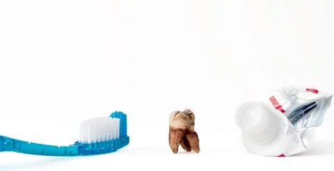 Single extracted molar tooth with caries decay and filling with tooth paste a Foto stock