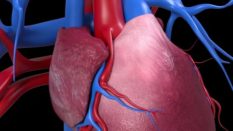 Single Heart Bypass Stock Footage 250268787