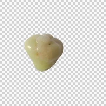 A single human molar tooth with a cavity isolated on a plain background Фото