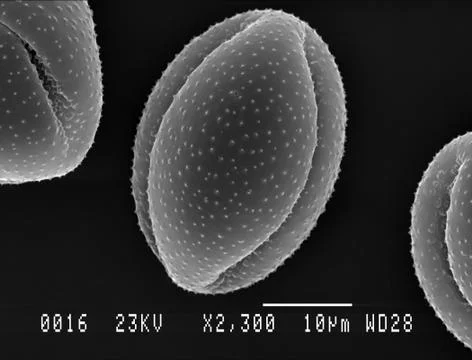 Single Lesser Celandine pollen grain Stock Photos