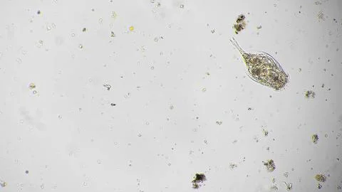 Single rotifer amidst algae visuals. Microscope captures solitary rotifer among Stock Photos