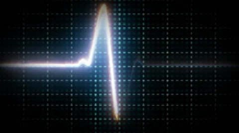 Sinus Heart Rhythm On Electrocardiogram Record Paper Showing Normal P Wave, PR Video stock 64349421