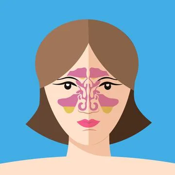 Sinusitis disease, vector nose illustration, sinus anatomy, human respiratory Stock Illustration