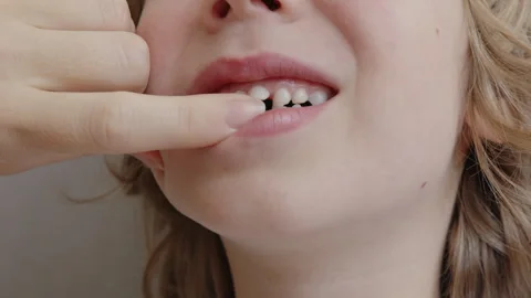A six-year-old boy carefully examines his loose baby teeth. Mother uses finger 스톡 동영상 337643522