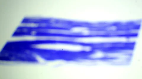 Skeletal muscle tissue longitudinal section under a microscope, Skeletal muscle  Stock Footage 47086793