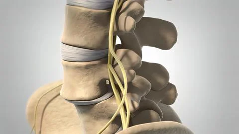 Skeletal system disc shift 3d medical Stock Illustration