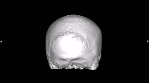 Skeletal system Human Skull scanner - 4K - ProRes Stock Footage 164237957