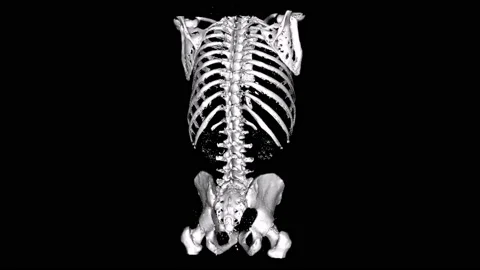 Skeletal system scanner 360 - 4K - ProRes Stock Footage 164237975