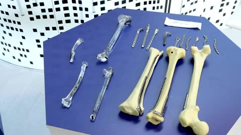 Skeleton bones and prosthetics metallic plates exhibition Video stock 162620869