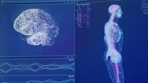 Skeleton, brain and DNA models on computer screen. Looking for damage. Stock Footage 160911676