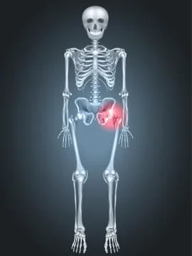 Skeleton with Hip pain Stock Illustration