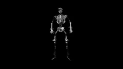 Skeleton Hologram 03 Stock Footage 248789072