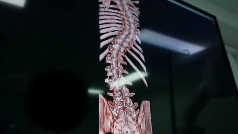 Skeleton of a human curved to the side.  Stock Footage 294981082