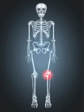 Skeleton with knee joint pain Stock Illustration