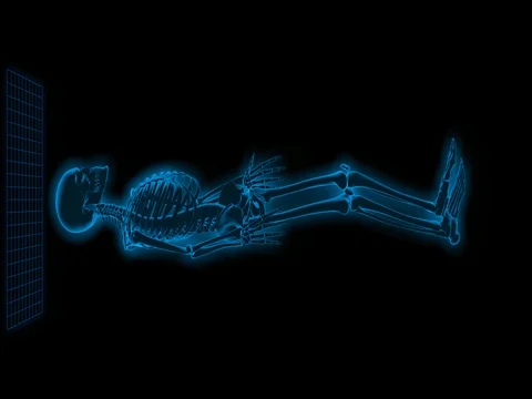 Skeleton scan concept Stock Footage 76486124