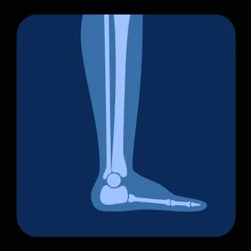 Skeleton x ray Stock Illustration