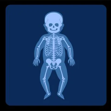 Skeleton x ray Stock Illustration