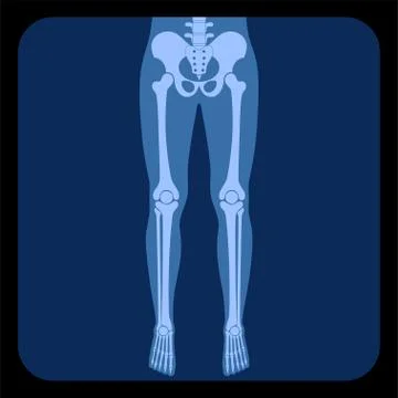 Skeleton x ray Stock Illustration