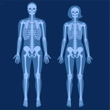 Skeleton x ray Stock Illustration