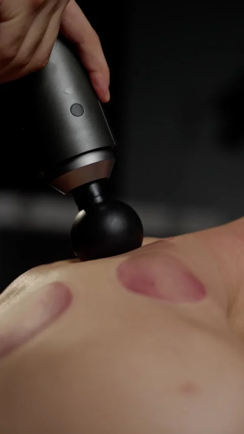 Skilled massage professional applying percussion massager on patient's back Stock Footage 300367275