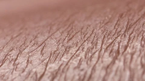 Skin 2 Video stock 326352302