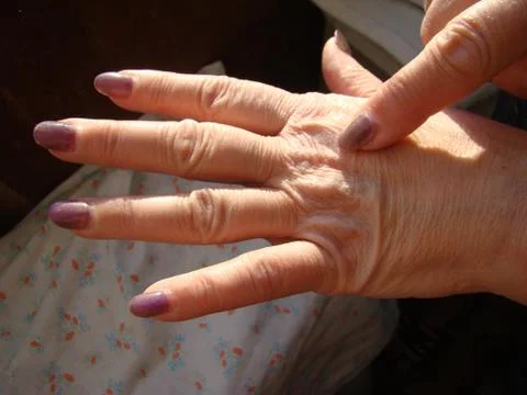 Skin aging Stock Photos