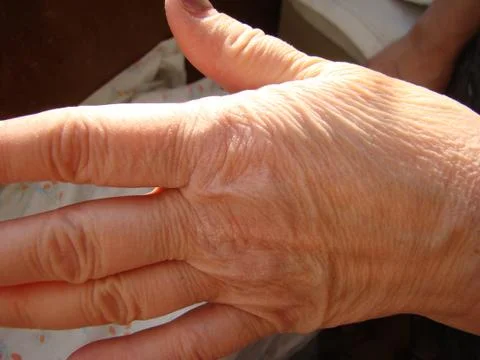 Skin aging Stock Photos