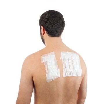 Skin Allergy Patch Test on Bacck Stock Photos