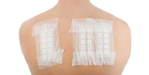 Skin Allergy Patch Test on Bacck Stock Photos