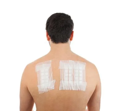 Skin Allergy Patch Test on Bacck Stock Photos