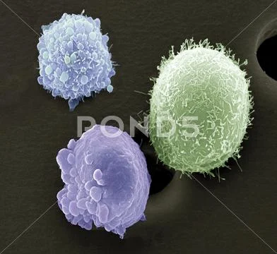 Skin Cancer Cells, Sem