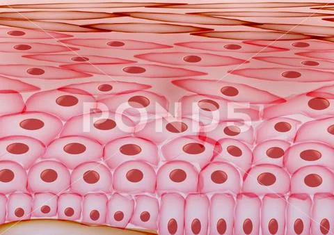 Skin Cells, Eczema, Inflamed Skin Layers - Vector Illustration: Graphic ...