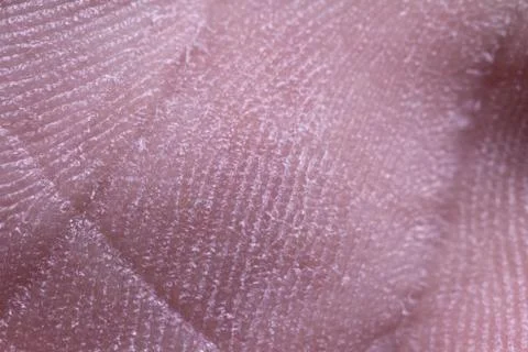 Skin close up Stock Photos