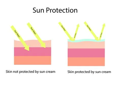 Skin compare between skin with broad-spectrum sunscreen protect both UVA and UVB Stock Illustration