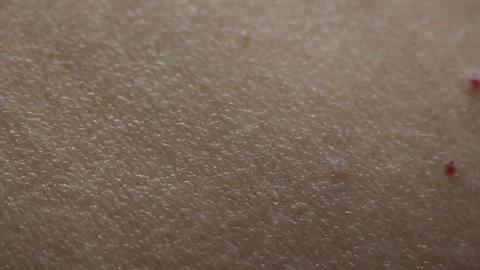 Skin Stock Footage 131848330