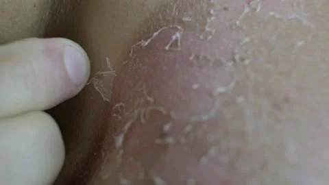 Skin Stock Footage 197756748