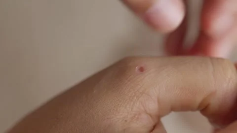 Skin Stock Footage 281359460