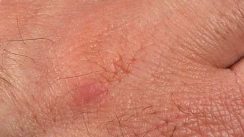 Skin on human hand macro. Human knuckles close up. Male skin. 4K Video stock 126119966