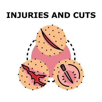 Skin injuries concept with various types of wounds Stock Illustration
