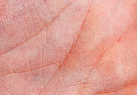 Skin Stock Photos