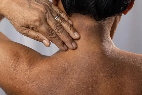 Skin problem for adults Stock Photos